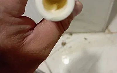 Su Kaçağı Tespiti Tamiri